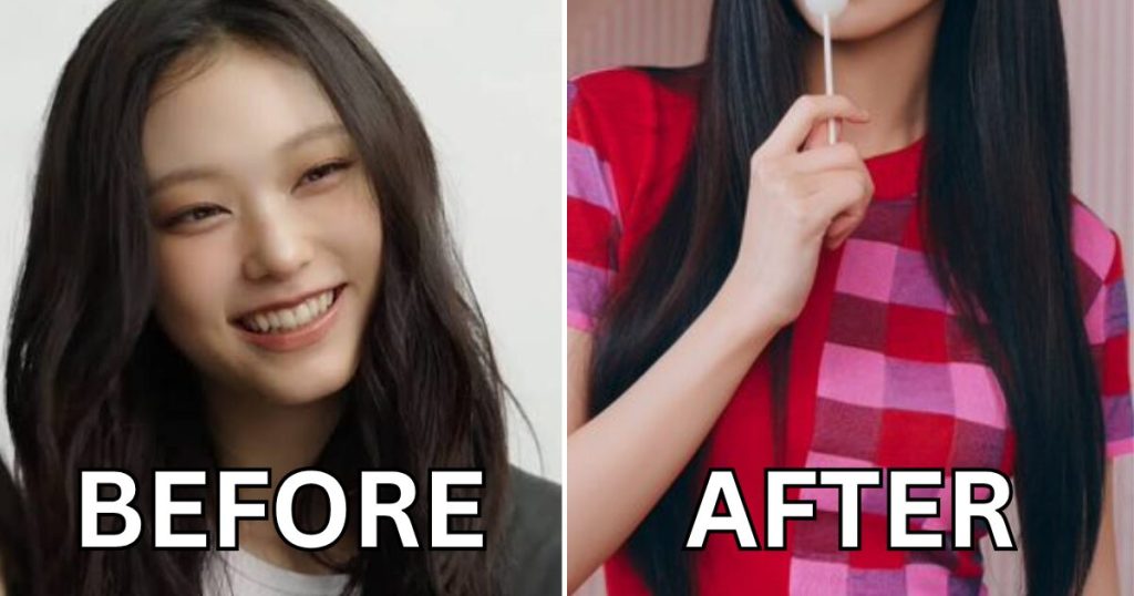 NewJeans Haerin Diduga Memiliki Prosedur Kosmetik yang Kontroversial