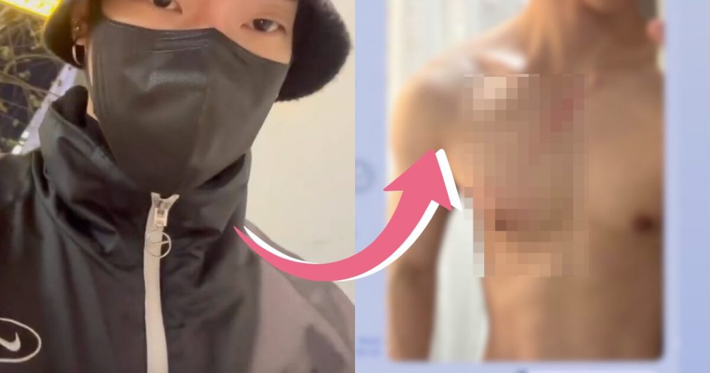 Aktor Pria Mengungkap Hubungan Gay Untuk Mengungkap Pelecehan Fisik dan Mental Mantan Terkenalnya