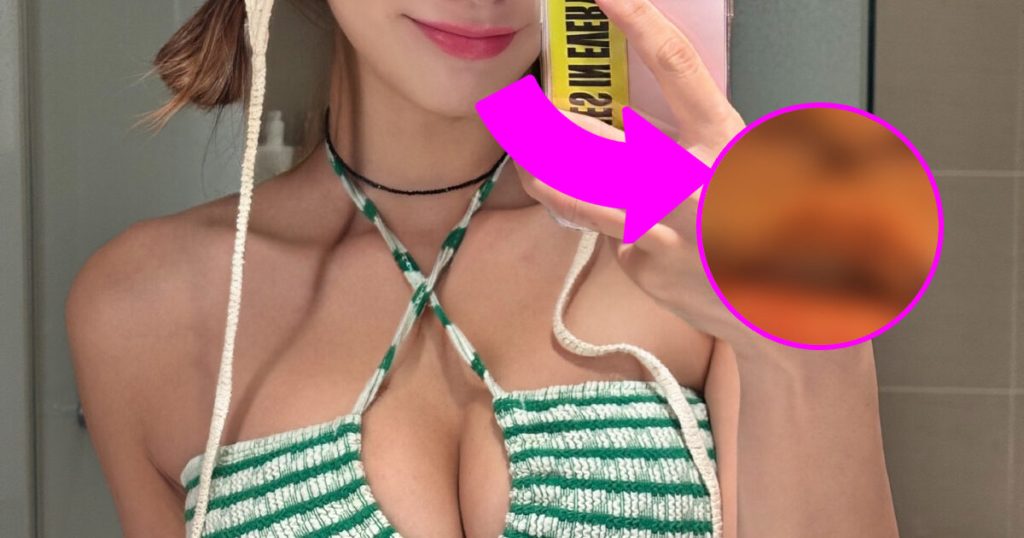 Bintang Korea Terkejut Dengan Perbandingan Sebelum dan Sesudah Operasi Philtrum dan Sudut Bibir